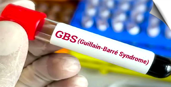 4 persons detected with Guillain-Barre Syndrome in MP's Mandsaur