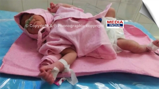 Baby girl just born 15 hours ago, dumped in the bush in cold winter